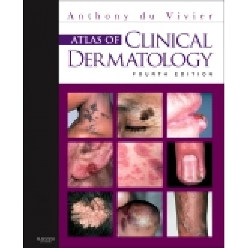 Atlas of Clinical Dermatology, 4th Edition
